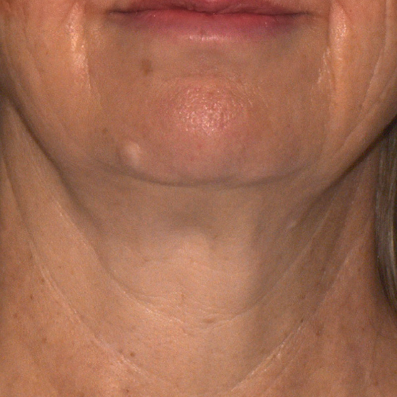 Caras Facial Center